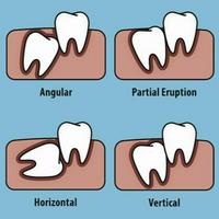 🔥 Wisdom tooth MBTI ENTP or ENTJ?